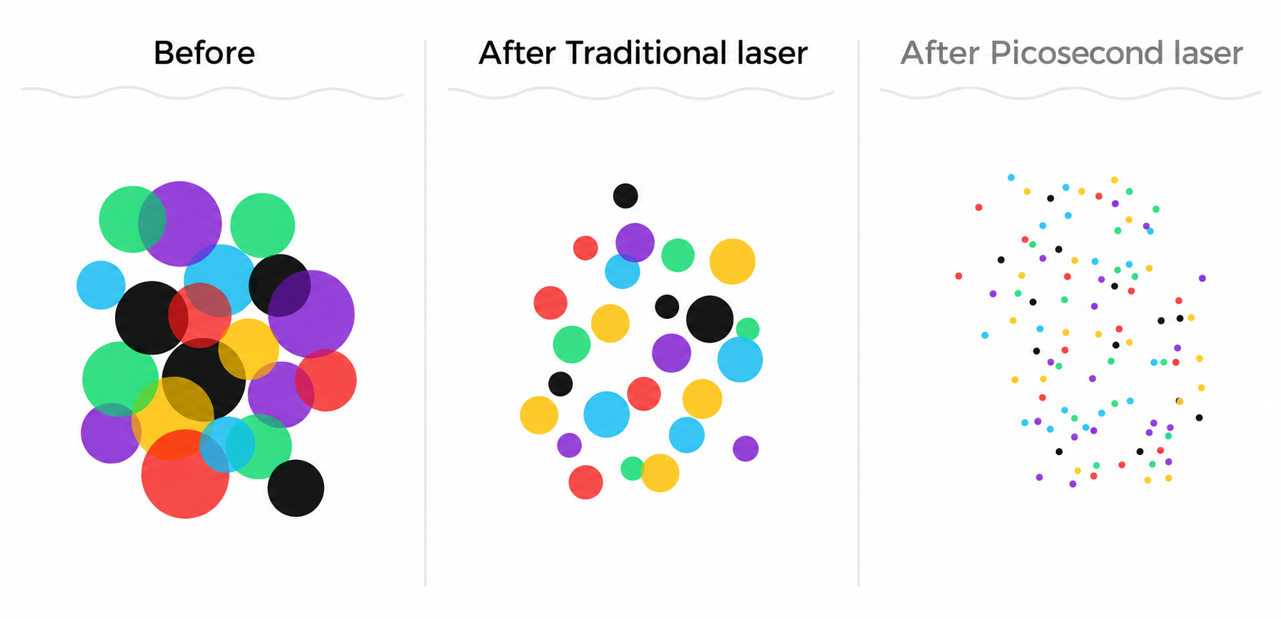 Picosecond laser pigment fragmentation diagram